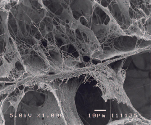 Interconnected Pores