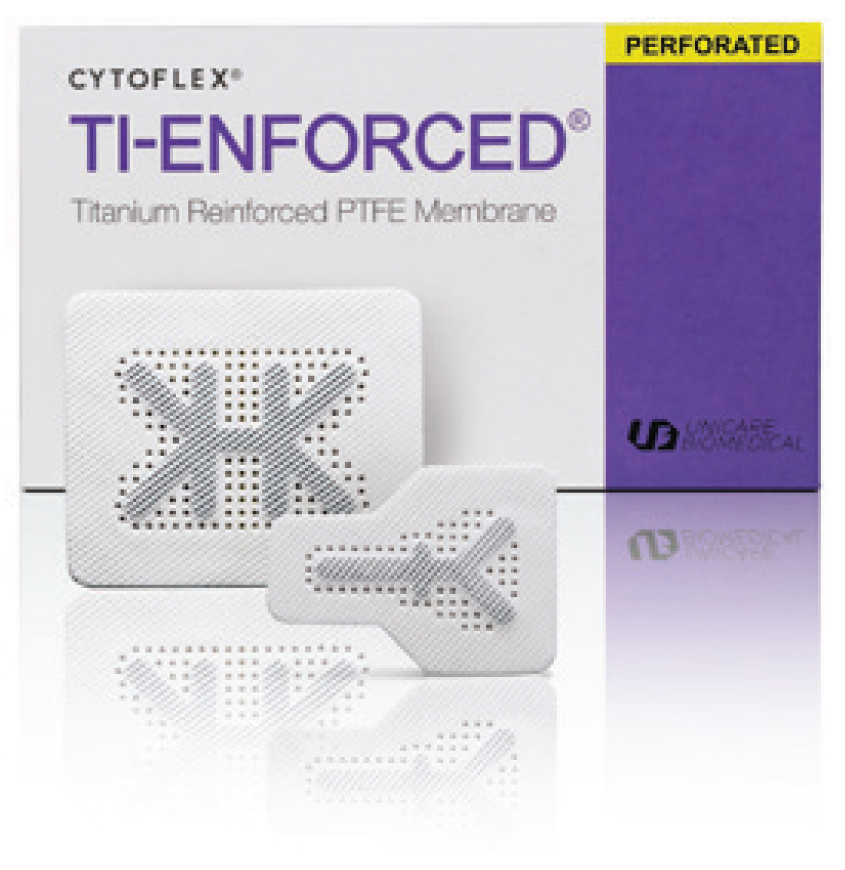 Perforated Ti-Enforced